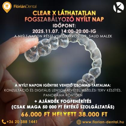 Clear X Nyílt Nap