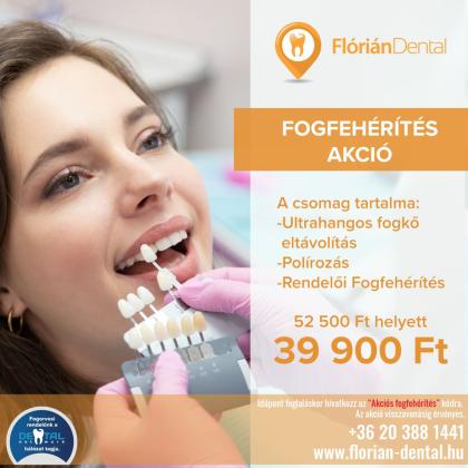 Fogfehérítés AKCIÓ Fogfehérítés AKCIÓ
