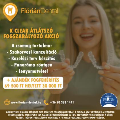 K Clear átlátszó fogszabályozó akció