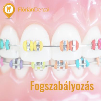 Fogszabályozás