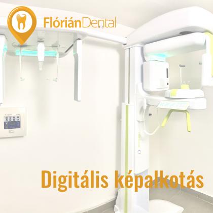 Digitális képalkotás - CT - Haifa Dent és Dentium Implant Centerben érhető el Digitális képalkotás - CT - Haifa Dent és Dentium Implant Centerben érhető el