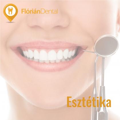 Cosmetic Dental Treatment!